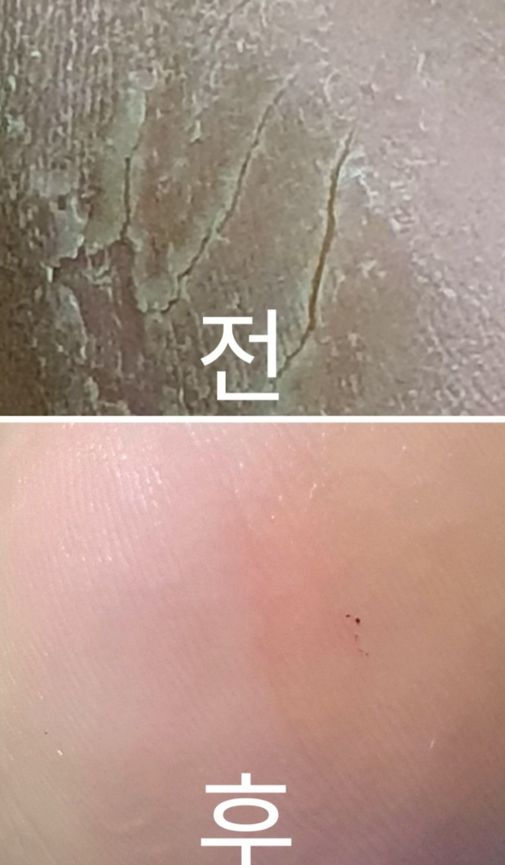 바렌 패디퍼펙트 전동 발각질제거기 세트 퍼플에디션 구매 후기 이미지